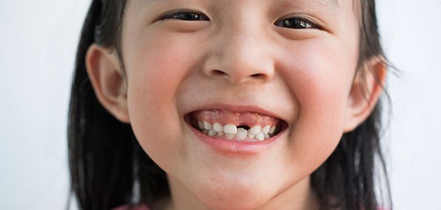 El orden de caída de los dientes de leche en los niños